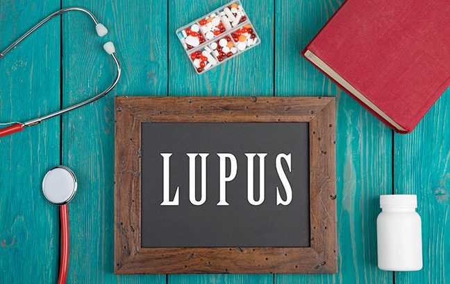 O que é Lupus?
